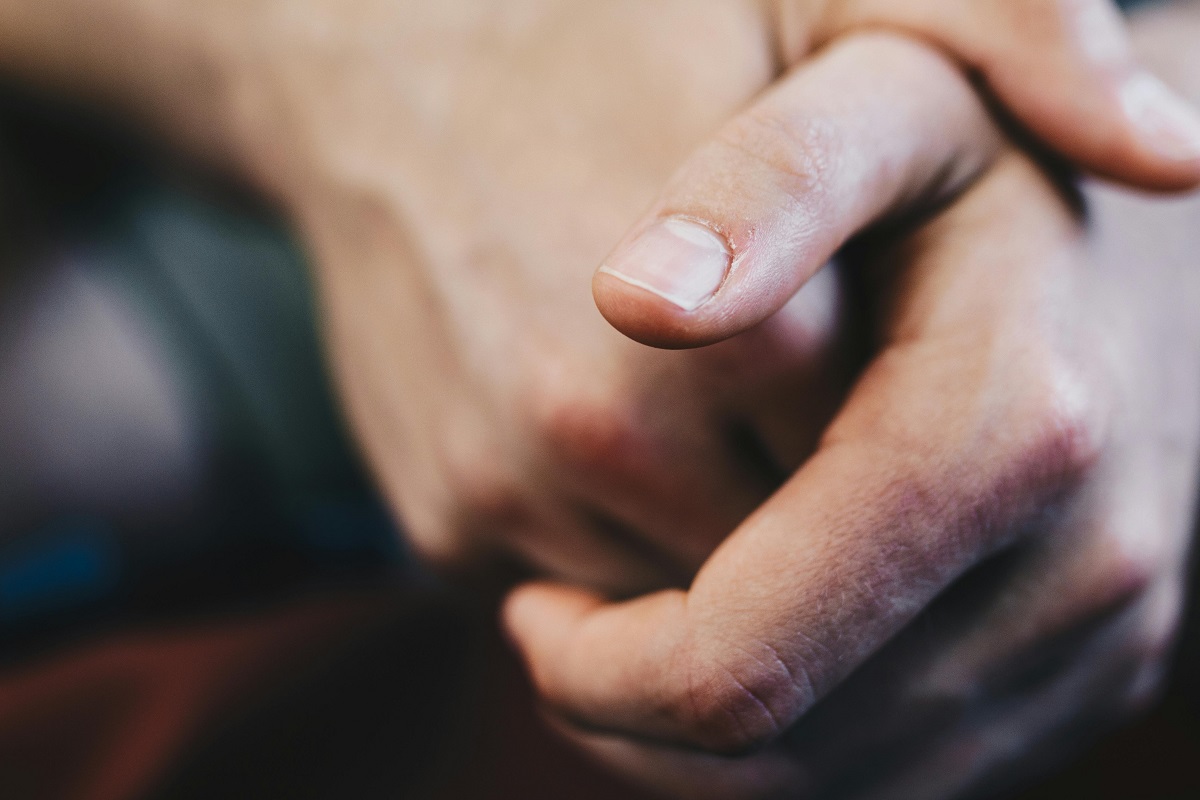 psoriazis tratament
